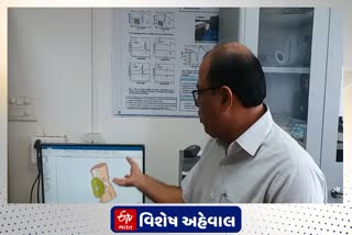 સુરત SVNITના પ્રોફેસર અને તેમના PHDના વિદ્યાર્થીઓએ ખાસ સેન્સર બનાવ્યું