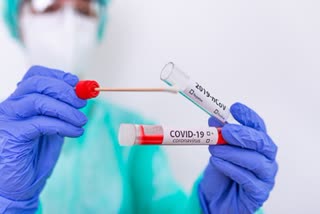 The Department of Health KERALA  new covid testing method in kerala  കൊവിഡ് പരിശോധന രീതി  കേരള ആരോഗ്യ വകുപ്പ്  സംസ്ഥാന ആരോഗ്യ വകുപ്പ്  State Health Department  തിരുവനന്തപുരം വാര്‍ത്ത  thiruvananthapuram news