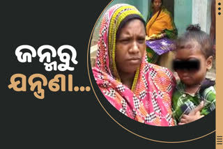 ଯନ୍ତ୍ରଣାରେ ଜୁଝୁଛି 2 ବର୍ଷୀୟ ବିକାଶ, ଅନ୍ଧପୁଟୁଳି ବାନ୍ଧି ବିତୁଛି ଜୀବନ