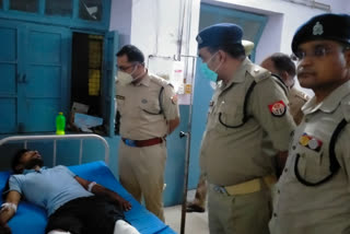 बदमाश को लगी पुलिस की गोली