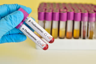 Blood disorder, thelassemia, aboriginal blood, hemoglobin disorder 