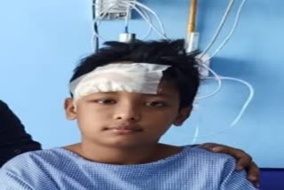 Injured boy