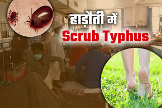 crub-typhus-disease-is-spreading-in-hadoti