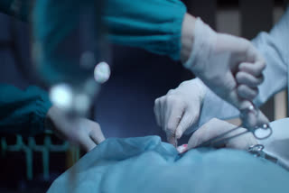 doctor left cotton in stomach during operation