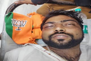 BJP Leader injured