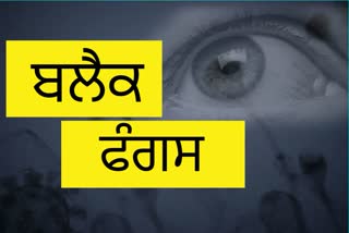 MP 'ਚ ਪਹਿਲਾ ਕੇਸ: ਡੇਂਗੂ ਦੇ ਮਰੀਜ਼ ਨੂੰ ਹੋਇਆ ਬਲੈਕ ਫੰਗਸ