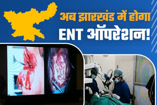 ent-operations-will-be-done-in-jharkhand