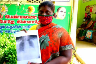 Xray results available on paper at Kovilpatti and Patients consolation