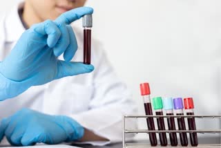 blood test, blood, body test, body monitoring, dementia, what is dementia, what is alzheimers, what are the symptoms of dementia, is there a treatment for dementia, how is dementia treated, is there a cure for alzheimers, how is dementia diagnosed, early signs of dementia, blood test to diagnose dementia, what test can diagnose dementia, who can have dementia, parkinsons, brain, brain health, neurological disorder, A Simple Blood Test May Spot Early Signs Of Dementia