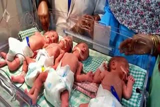 Woman delivers quadruplets in Hyderabad