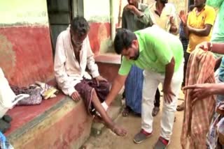 yadihalli villagers helps to orphan man who suffering with leg injury