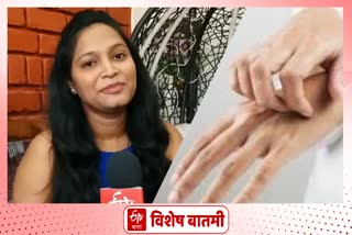 Winter has started, how to take care of skin; Exclusive Interview with Dermatologist