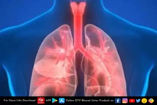 more-than-10-thousand-pneumonia-patients-found-in-last-2-months-in-uttar-pradesh