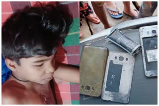 Seriously injured in phone blast