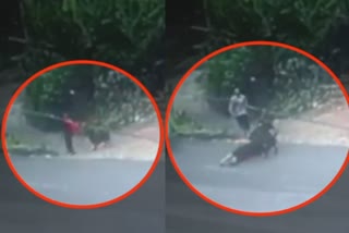 Woman seriously injured after being bitten by three dogs, dog attacked women, dog attacked women in kerala, பெண்ணை கடித்த நாய்கள், கேரளாவில் பெண்ணை கடித்த நாய்கள்