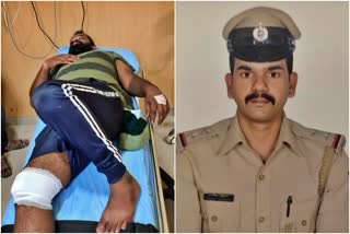 police-shot-on-accused-leg-and-arrested-in-bangalore