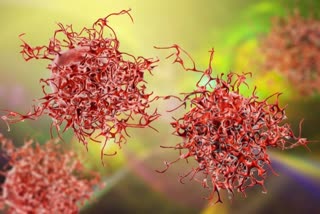 Cancer Cells Use 'Tiny Tentacles' To Suppress Immune System, cancer, what is cancer, what is tumor, what are the types of cancer, what are cancer cells, how to cancer cells work, immune system, immunity, immunotherapy, health, how to prevent cancer