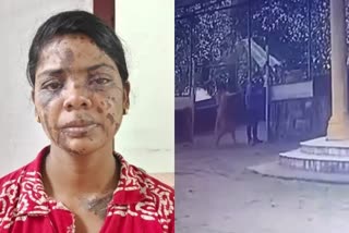 Kerala: Woman throws acid on a man; arrested