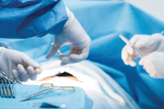 doctors remove whistle from lungs of a 12 year old boy by a rare surgery in sskm