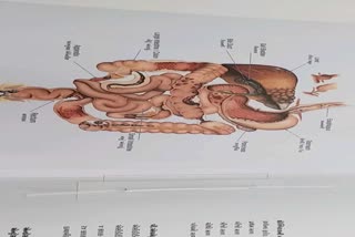 Indian journal of Gastroenterology: આંતરડામાં ચાંદાની બીમારીમાં રાજકોટના ડોક્ટરનું દેશમાં સૌથી મોટું સંશોધન