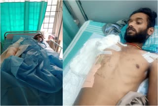 ಪೊಲೀಸರ ಹೊಡೆತಕ್ಕೆ ಬಲಗೈ ಕಳೆದುಕೊಂಡ ಯುವಕ,Young boy lost right hand by police assault in bengaluru