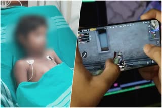 PUBG game addicted child gets nerve damage  പബ്‌ജി ഗെയിമിന് അടിമയായ കുട്ടിക്ക് നാഡി തകരാർ  ഗെയിമിന് അടിമപ്പെട്ട കുട്ടി കോമയിൽ  Child addicted to game in coma condition