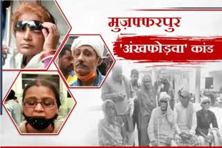 Muzaffarpur Eye Hospital Case etv bharat