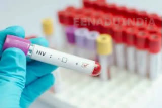 How HIV replicates in the body