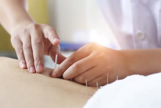 how is acupuncture is beneficial for weight loss, difference between acupuncture and acupressure, weight gain, वजन कम करने में मददगार हो सकती है एक्यूपंक्चर पद्धति