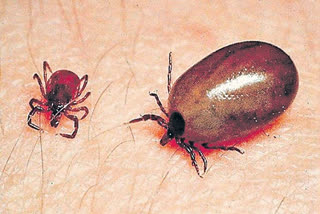 Scrub typhus cases in hyderabad , Scrub typhus cases in children