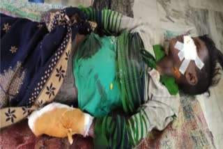child-injured-due-to-bomb-explodes-at-radhanagar-police-station-in-sahibganj