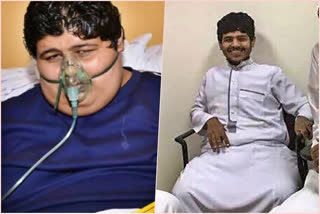 Weight loss by World heaviest teen, Khaled Mohsen Al Shaeri weight loss, Weight loss by Saudi Arabian teen, Khaled Mohsen Al Shaeri weight, Khaled Mohsen Al Shaeri news, ತೂಕ ಇಳಿಸಿದ ವಿಶ್ವದ ಅತ್ಯಂತ ಭಾರವಾದ ಯುವಕ, ಖಲೀದ್ ಮೊಹ್ಸೆನ್ ಅಲ್ ಶೇರಿ ತೂಕ ಇಳಿಕೆ, ತೂಕ ಇಳಿಸಿಕೊಂಡ ಸೌದಿ ಅರೇಬಿಯನ್​ ಯುವಕ, ಖಲೀದ್ ಮೊಹ್ಸೆನ್ ಅಲ್ ಶೇರಿ ತೂಕ, ಖಲೀದ್ ಮೊಹ್ಸೆನ್ ಅಲ್ ಶೇರಿ ಸುದ್ದಿ,