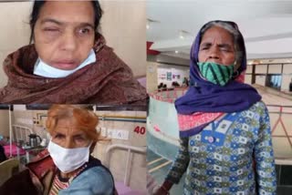 EYES OF 27 PATIENTS DETERIORATED AFTER CATARACT OPERATION