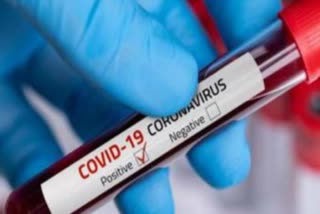 woman tested covid19 positive