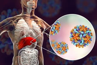 Hepatitis Cases