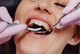 Gum Disease:مسوڑھوں کی بیماری دل کی بیماری اورسائیکوسس کا خطرہ بڑھا سکتی ہے