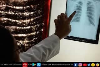 TB Disease Awareness
