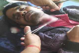 knife-attack-on-veterinary-doctor-in-palamu