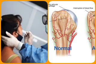 avascular narcosis problem