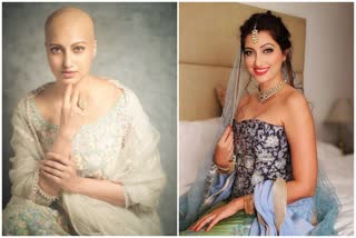 Telugu Actress Hamsa Nandini  Breast Cancer Treatment  Hamsa PhotoShoot gets Viral in Social Media  Social Media viral Photoshoot  Hamsa Nandini Films  Hamsa Nandini Photoshoot  fashion photographer Rohan Shrestha  ഹംസ നന്ദിനി ഫോട്ടോഷൂട്ട്‌  സ്‌തനാര്‍ബുദ ചികിത്സ  കാന്‍സര്‍ കിമോതെറാപ്പി   സമൂഹമാധ്യമത്തില്‍ വൈറല്‍ ഫോട്ടോഷൂട്ട്‌  ഹംസ നന്ദിയുടെ ഫോട്ടോഷൂട്ട് വൈറല്‍  ഫാഷൻ ഫോട്ടോഗ്രാഫര്‍ രോഹൻ ശ്രേഷ്ഠ