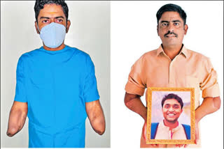 Bellary Man Lost Both Hands In An Accident, Bellary man Get A New Pair Through Transplant, Kerala Amruth hospital, Bellary hand transplant news, ಅಪಘಾತವೊಂದರಲ್ಲಿ ಕೈಗಳನ್ನು ಕಳೆದುಕೊಂಡ ಬಳ್ಳಾರಿ ವ್ಯಕ್ತಿ, ಬಳ್ಳಾರಿ ವ್ಯಕ್ತಿಗೆ ಹೊಸ ಕೈಗಳು ಜೋಡಣೆ, ಕೇರಳದ ಅಮೃತ ಆಸ್ಪತ್ರೆ, ಬಳ್ಳಾರಿ ಕೈ ಜೋಡಣೆ ಸುದ್ದಿ,