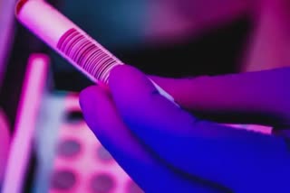 Kriya Medical RT PCR Kit: ક્રિયા મેડિકલ ટેક્નોલોજીસને RT-PCR કિટ માટે DCGIએ આપી મંજૂરી
