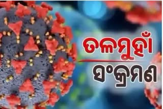 Odisha corona: ଦିନକରେ 925 ପଜିଟିଭ ଚିହ୍ନଟ