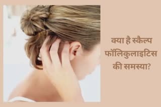 Problem of Folliculitis : મસ્તિષ્ક ત્વચાની આ ગંભીર સમસ્યાથી કઇ રીતે બચી શકાય? નિષ્ણાત પાસે જાણો