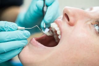 what is oral cancer, what are the causes of oral cancer, who is at risk of oral cancer, how to prevent oral cancer, is oral cancer hereditary