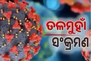 Odisha Corona Report: ୧୦୦ ତଳେ ସଂକ୍ରମଣ