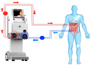 Cancer Treatment in AIIMS Jodhpur