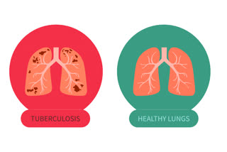 World Tuberculosis Day