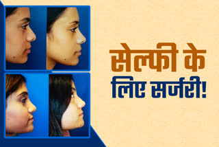 Rhinoplasty Reshaping Surgery Operation Indore