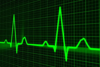 An ECG is an inexpensive, non-invasive, easily attainable and widely available test applied in nearly all hospitalised patients